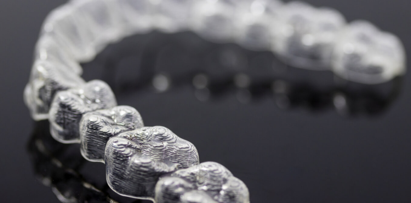 Consulta Invisalign