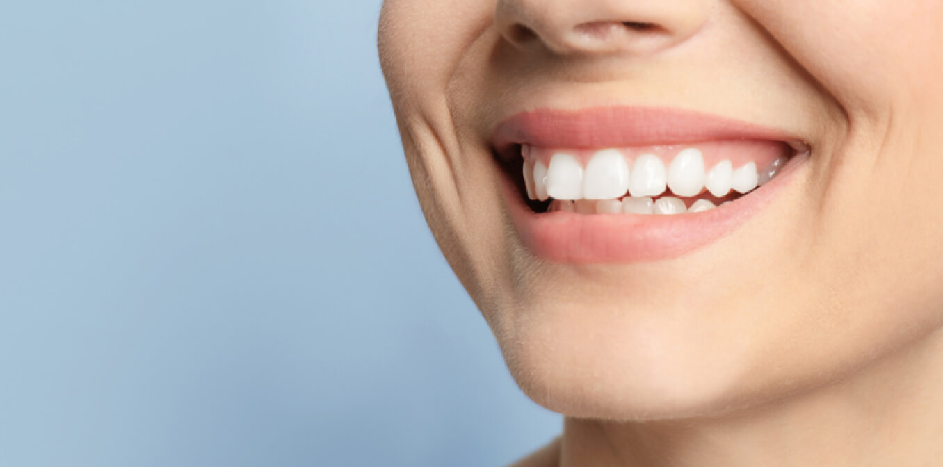 Implantes Dentales Consulta
